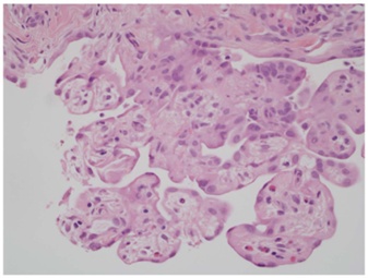 Asbestos laws in kansas asbestos publicity in infants