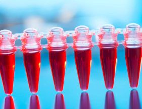 Blood vials in a laboratory Blood vials in a laboratory