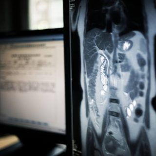 X-ray of abdomen on computer screen