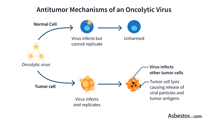 Antitumor Mechanisms of an Oncolytic Virus. The illustration depicts an oncolytic virus infecting a normal cell but unable to replicate, leaving the normal cell unharmed. A second example shows an oncolytic virus infecting a tumor cell, replicating and causing lysis which ruptures the tumor cell and promotes antitumor immune response.