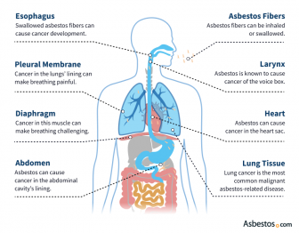 Diagram showing how asbestos exposure affects the body