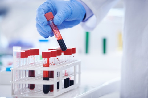 Blood test