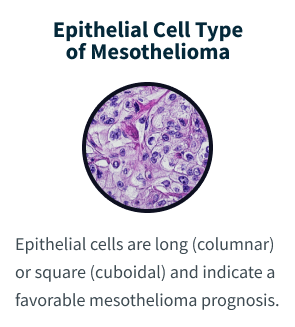 Epithelial Cell Type of Mesothelioma.Epithelial cells are long (columnar) or square (cuboidal) and indicate a favorable mesothelioma prognosis.
