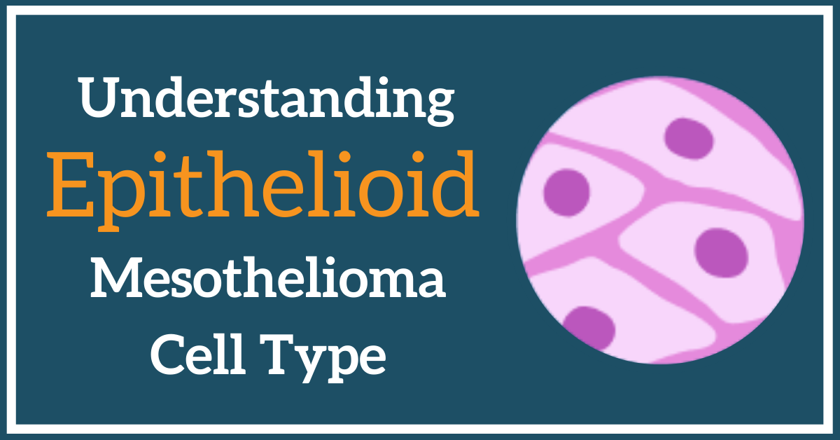 Epithelioid Mesothelioma: Symptoms, Treatments, & Prognosis