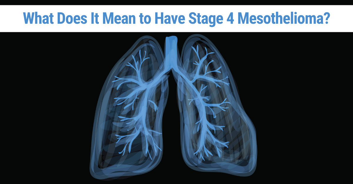 can you survive stage 3 pancreatic cancer