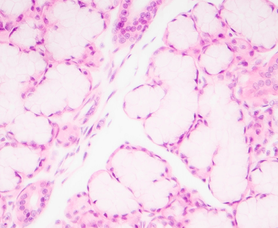 Microscope view example of an Glandular cell