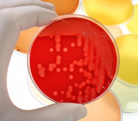 Petri dish with culture in red agar