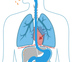 Asbestos Fibers in the heart.