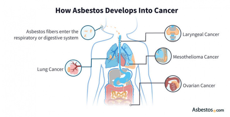 How asbestos develops into different types of cancer