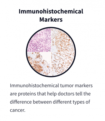 Immunohistochemical Markers: Immunohistochemical tumor markers are proteins that help doctors tell the difference between different types of cancer. A composite image taken under a microscope shows cells of various types stained in different colors to highlight differences in cancer diagnosis.