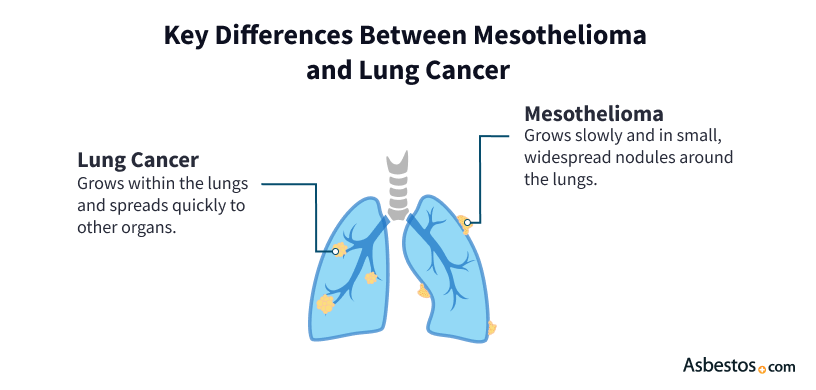 mesothelioma vs. lung cancer