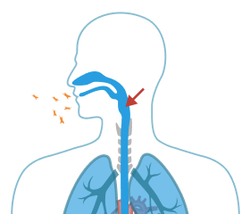 Asbestos Fibers enters the larynx.