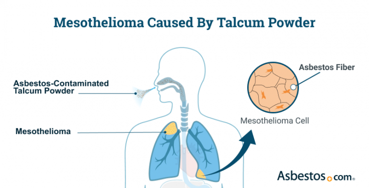 Asbestos-contaminated talc can be inhaled, risking mesothelioma.