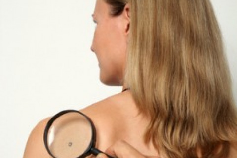 Man holding a magnifying glass and looking at a mole on woman's back