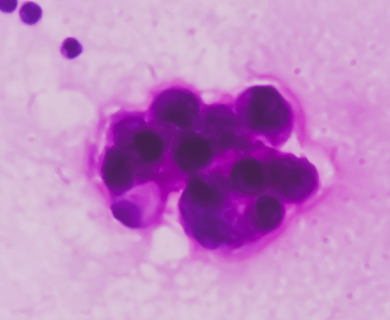 Microscope view example of an Small cell