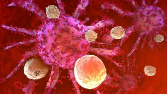 T cells attack cancer cells in immunotherapy