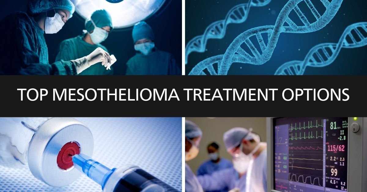 Malignant Mesothelioma Treatment Guide: Options for Treatment