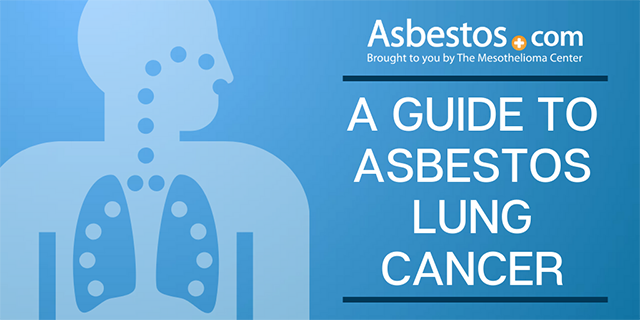 mesothelioma cancer of the stomach