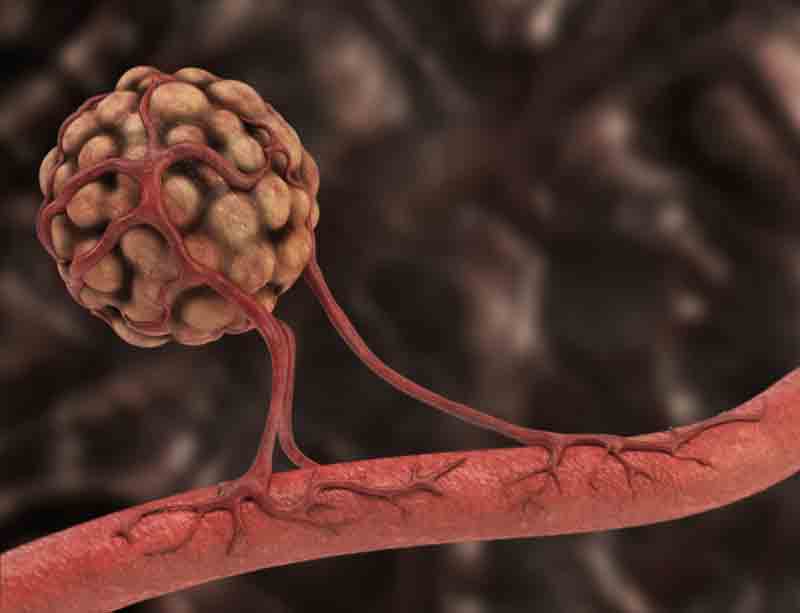 mesothelioma survival rates mesothelioma survival rates
