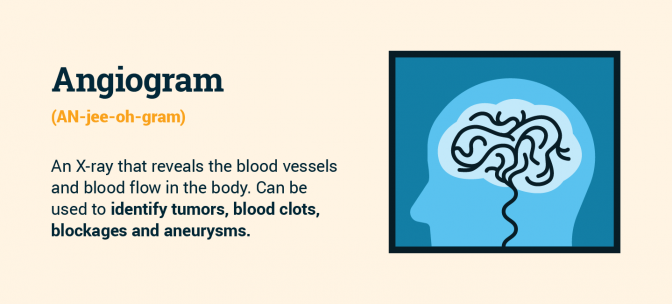 Angiogram definition
