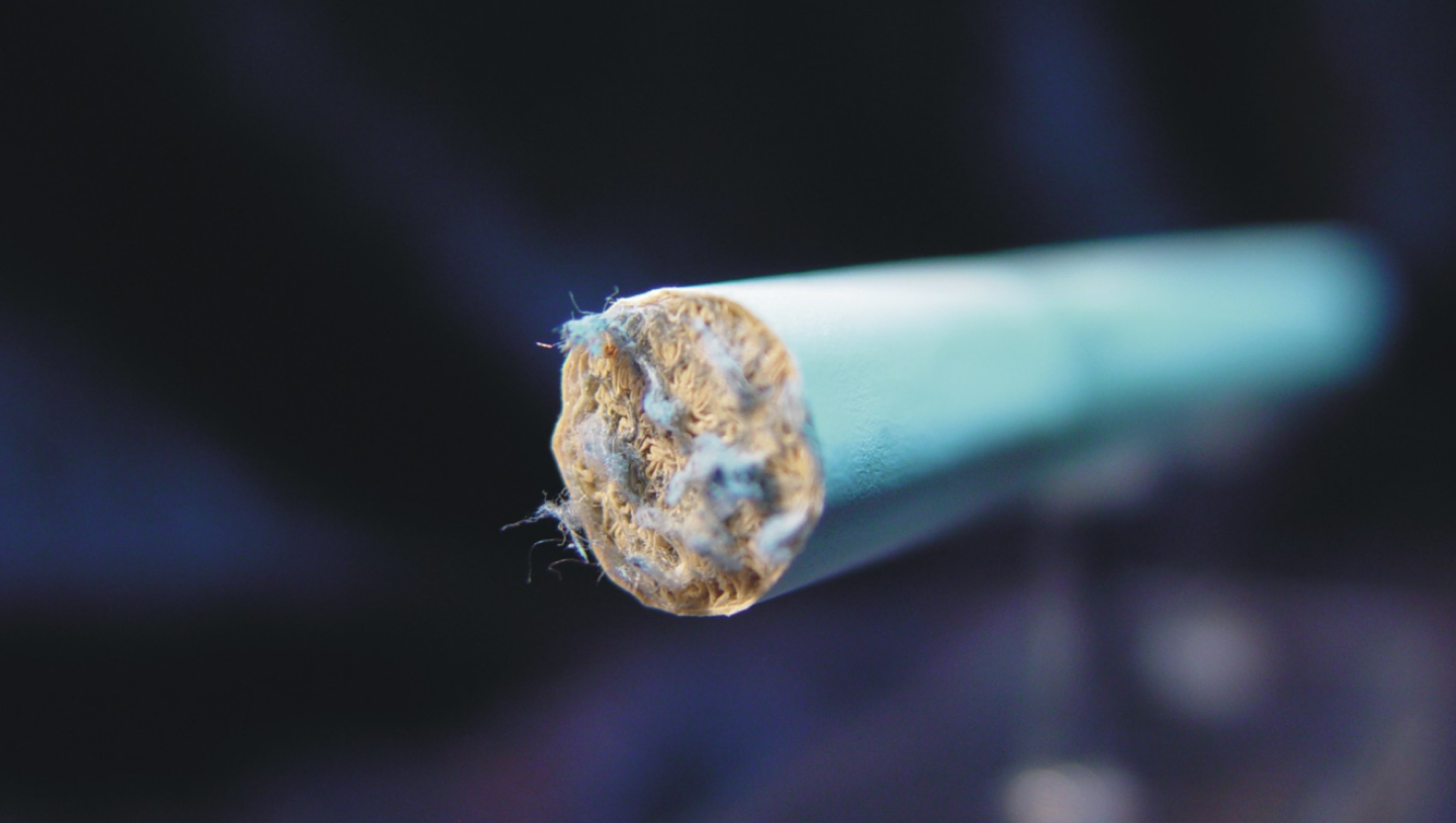 does asbestosis cause lung nodules