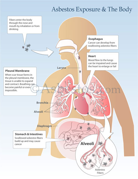 What Is Asbestos?