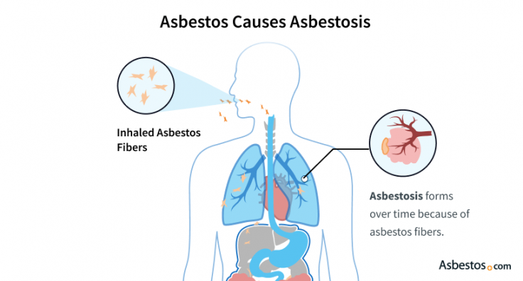 How asbestos causes asbestosis