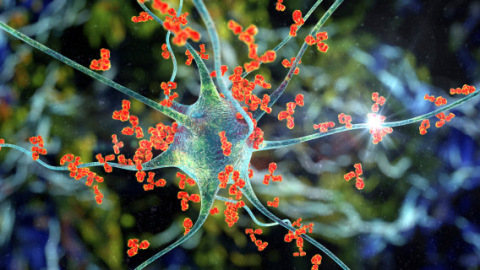 Antibodies attacking neuron