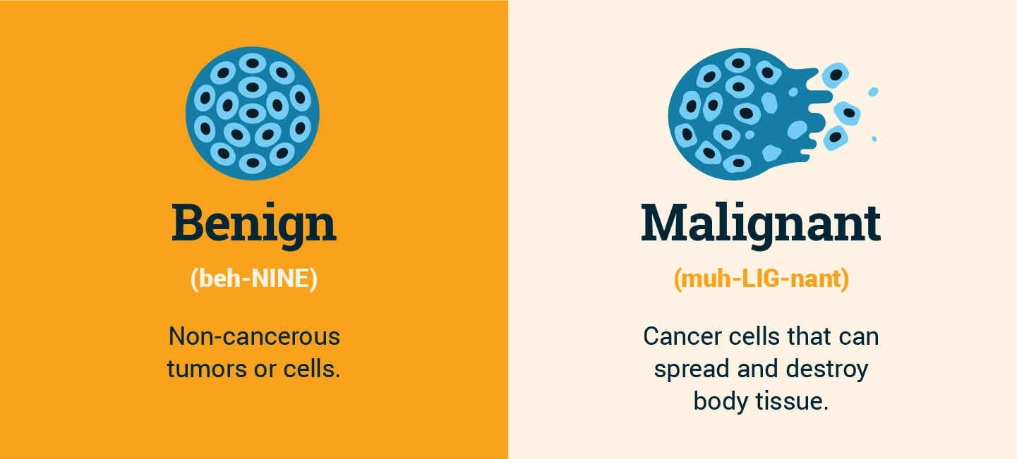 Benign Mesothelioma - Types & Treatment Options