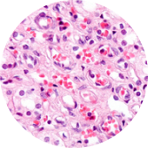 biphasic pink cell icon