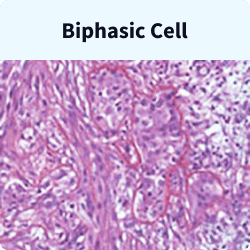 Biphasic mesothelioma cells