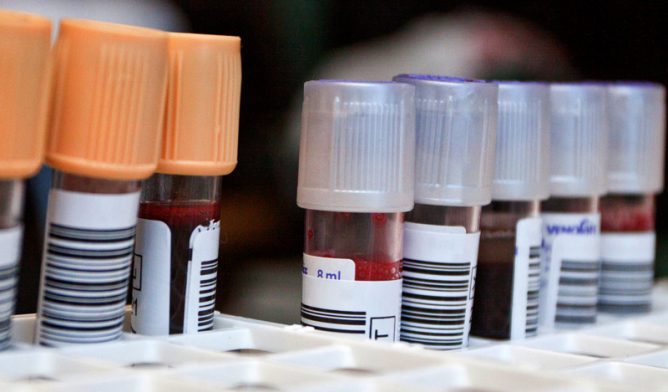 Blood samples in tubes