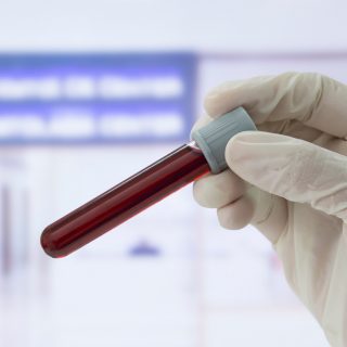 Blood sample