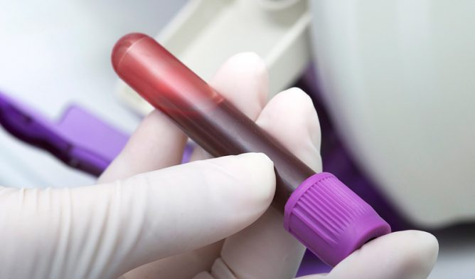 Blood sample