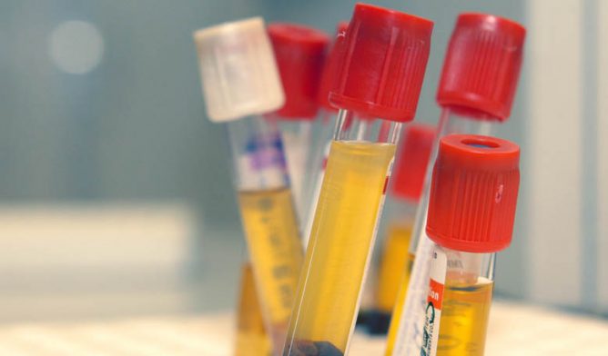 Test tubes with red cover stored in laboratory rack