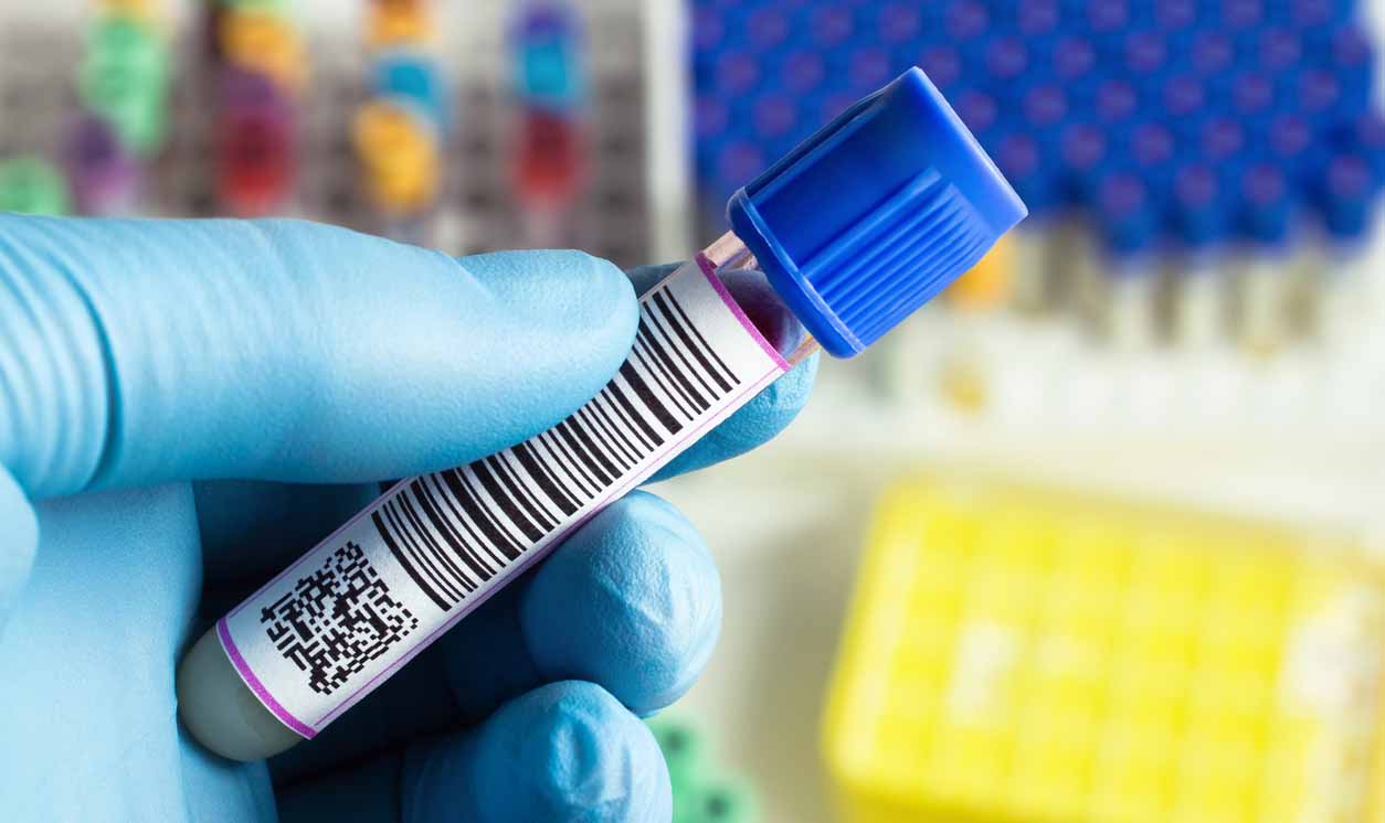 Targeting Blood-Clotting Pathway Improves Mesothelioma Treatment
