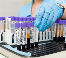 Researcher with gloves holds test tubes in a tray