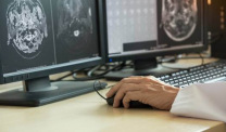 Technician views brain scan for metastasis