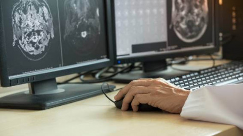 Technician views brain scan for metastasis