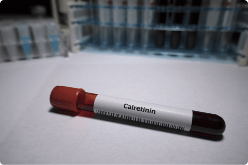 Calretinin protein in a laboratory vial