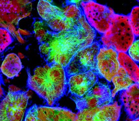 False color cancer cells