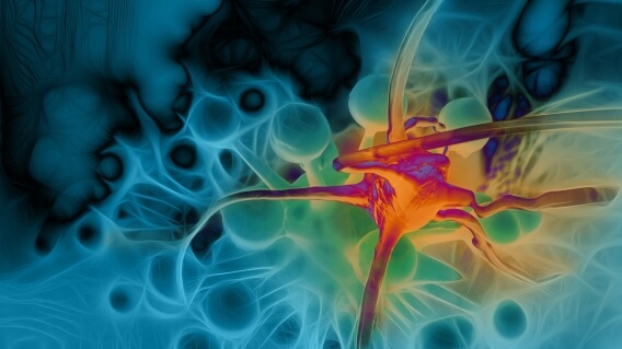 Orange and blue 3D image of cancer cell