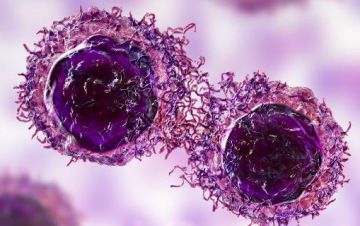 Illustration of cancer cells