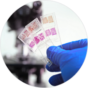 Cell stains examined in laboratory
