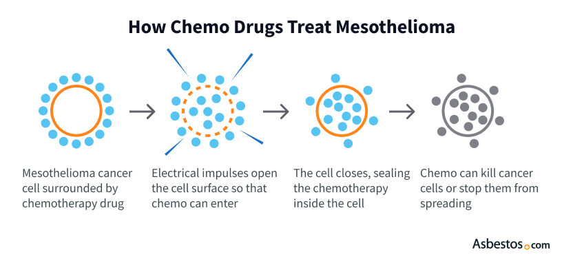 mesothelioma define