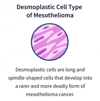 Desmoplastic mesothelioma cells graphic