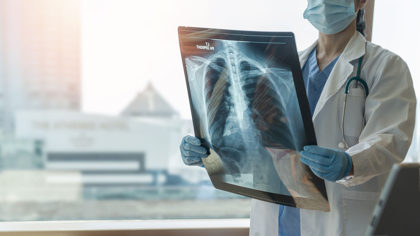 Doctor holding x ray scans of a chest.