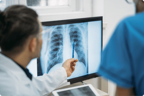 Doctor reviewing an X-ray with a technician