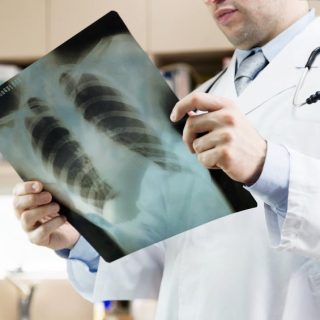 Doctor showing x-ray of lungs. hospital. medical check.