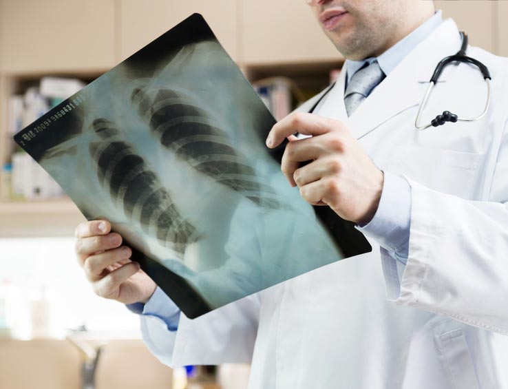 Doctor showing x-ray of lungs. hospital. medical check. Doctor showing x-ray of lungs. hospital. medical check.